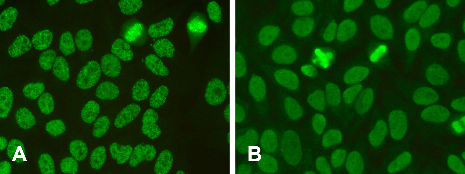 New patterns in ANA diagnostics - Euroimmun Blog