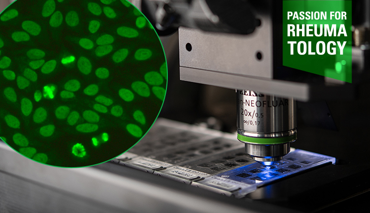 New patterns in ANA diagnostics